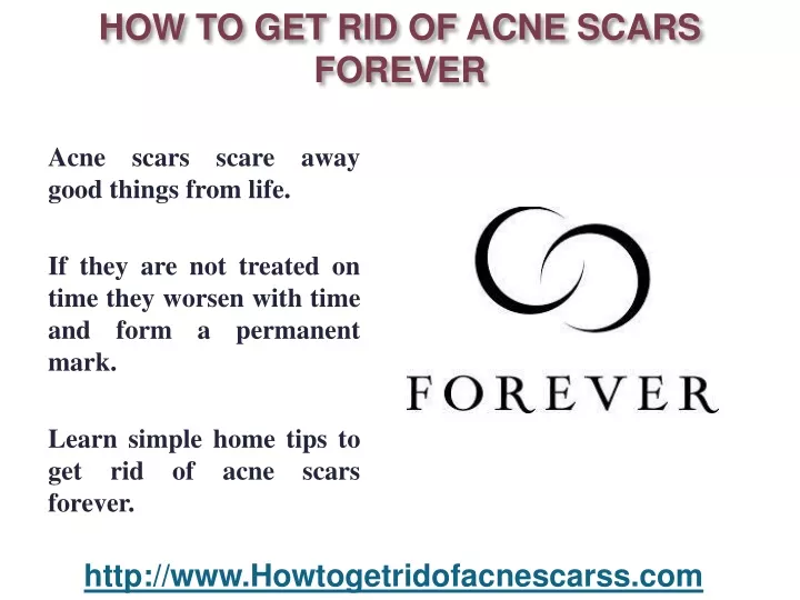 how to get rid of acne scars forever
