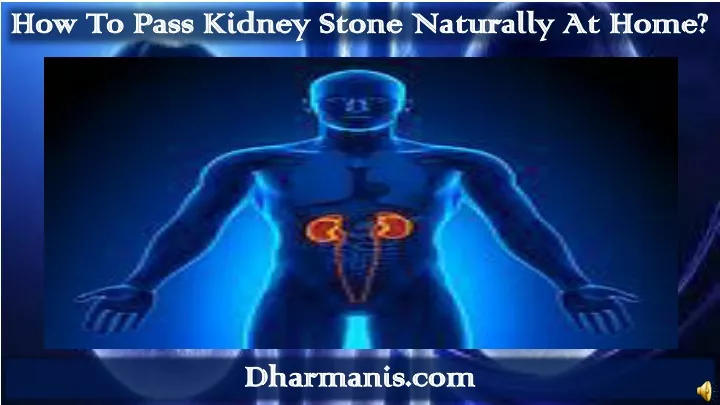 how to pass kidney stone naturally at home