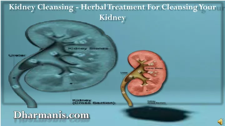 kidney cleansing herbal treatment for cleansing