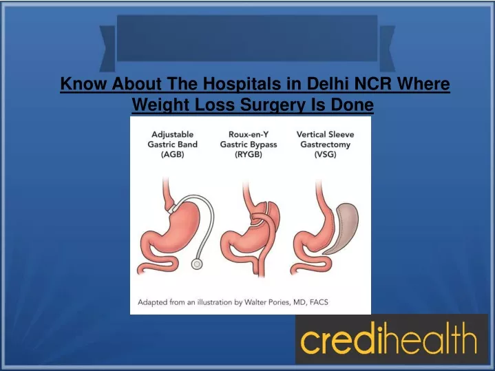 know about the hospitals in delhi ncr where