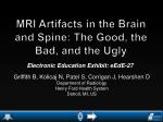 MRI Artifacts in the Brain and Spine: The Good, the Bad, and the Ugly