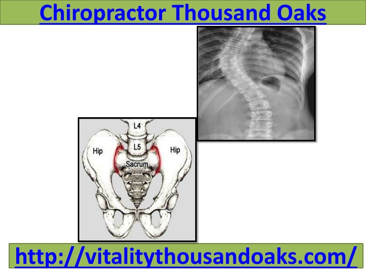 chiropractor thousand oaks