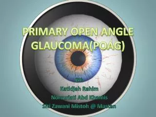 PRIMARY OPEN ANGLE GLAUCOMA(POAG)