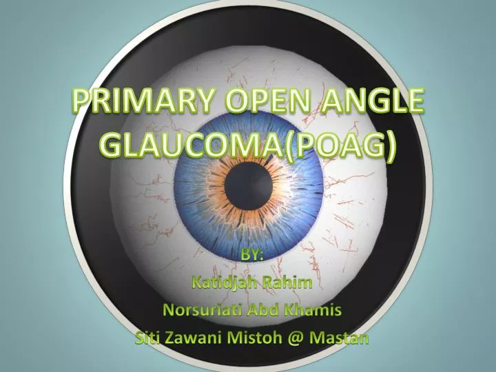 primary open angle glaucoma poag
