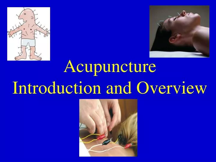 acupuncture introduction and overview