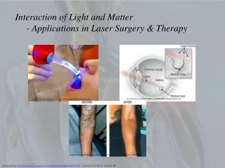 Interaction of Light and Matter 	- Applications in Laser Surgery &amp; Therapy