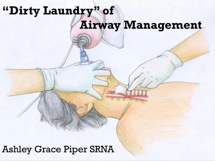 dirty laundry of airway management