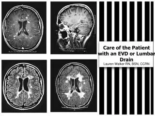 Care of the Patient with an EVD or Lumbar Drain