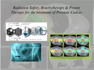 Radiation Safety, Brachytherapy &amp; Proton Therapy for the treatment of Prostate Cancer