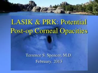 LASIK &amp; PRK: Potential Post-op Corneal Opacities