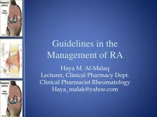Guidelines in the Management of RA