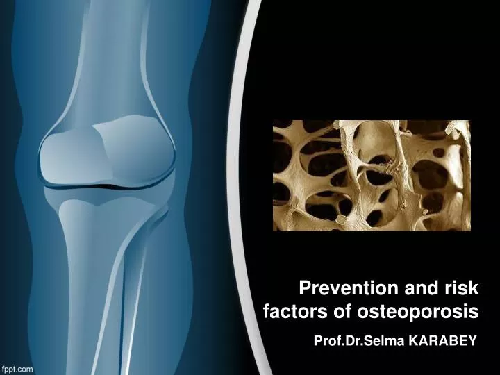 prevention and risk factors of osteoporosis
