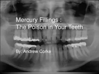 Mercury Fillings : The Poison in Your Teeth
