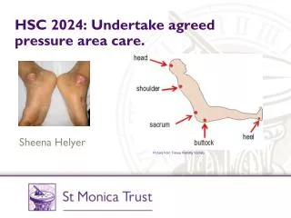 HSC 2024: Undertake agreed pressure area care.