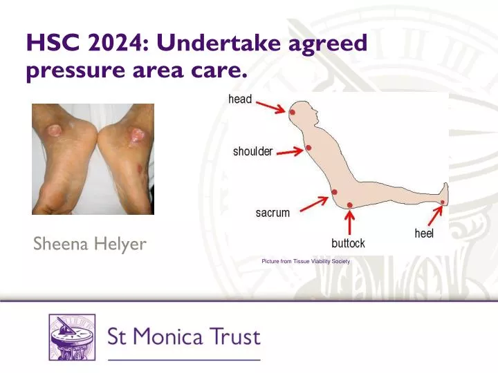 hsc 2024 undertake agreed pressure area care