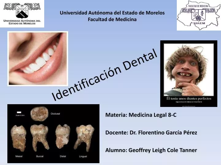 identificaci n dental