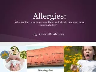 Allergies: What are they, why do we have them, and why do they seem more common today?
