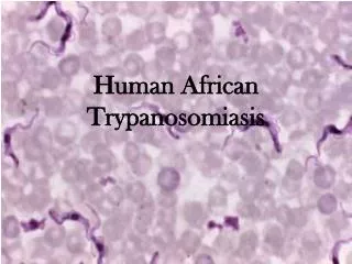 Human African Trypanosomiasis