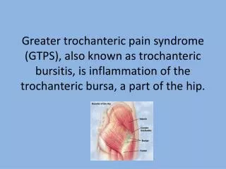 Greater trochanteric pain syndrome (GTPS), also known as trochanteric bursitis, is inflammation of the trochanteric burs
