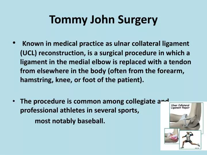 tommy john surgery