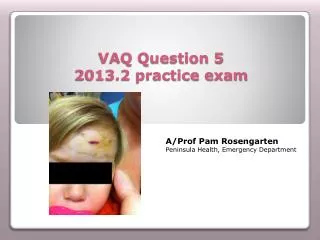 VAQ Question 5 2013.2 practice exam