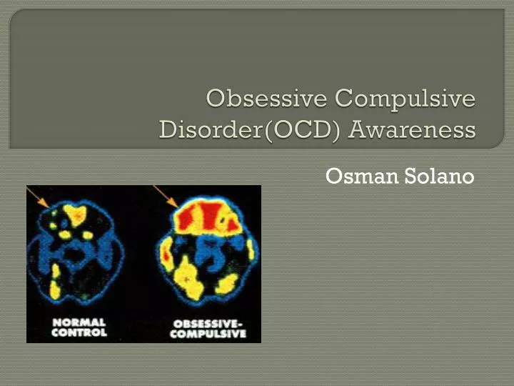 obsessive compulsive disorder ocd awareness