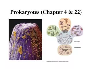 Prokaryotes (Chapter 4 &amp; 22)