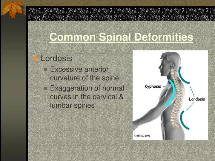 common spinal deformities