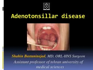 Adenotonsillar disease