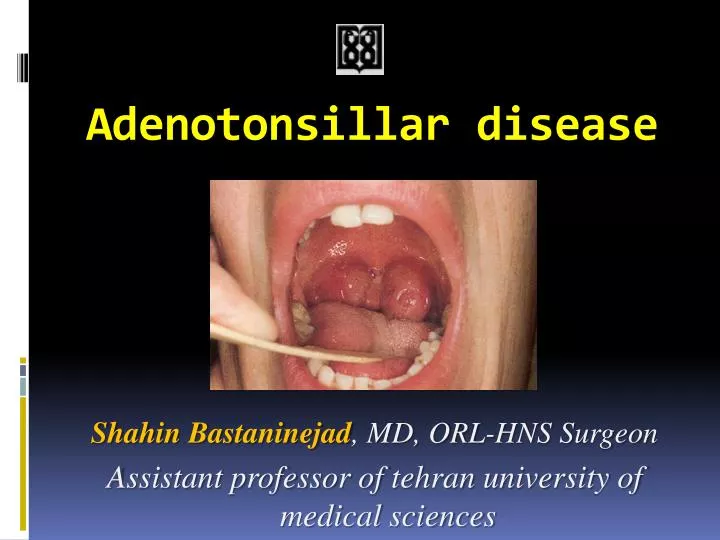 adenotonsillar disease