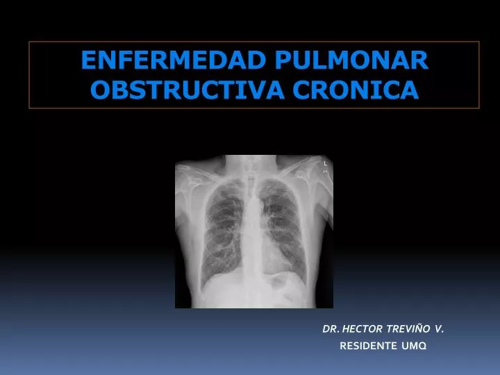 enfermedad pulmonar obstructiva cronica