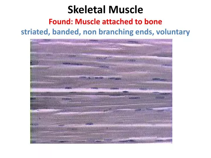 skeletal muscle found muscle attached to bone striated banded non branching ends voluntary