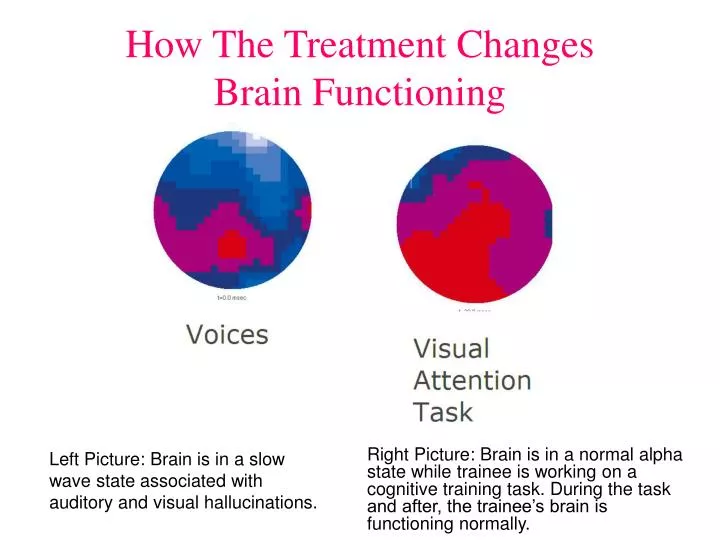how the treatment changes brain functioning