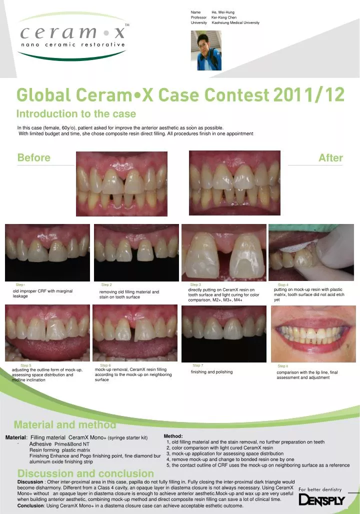 Introducing Ceramic Resin for the Form 2