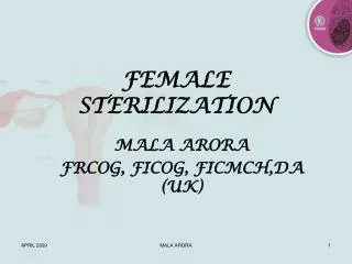FEMALE STERILIZATION