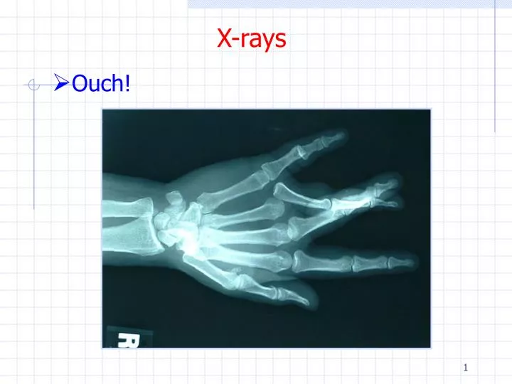 x rays