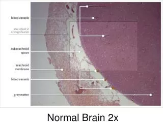 Normal Brain 2x