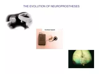 THE EVOLUTION OF NEUROPROSTHESES