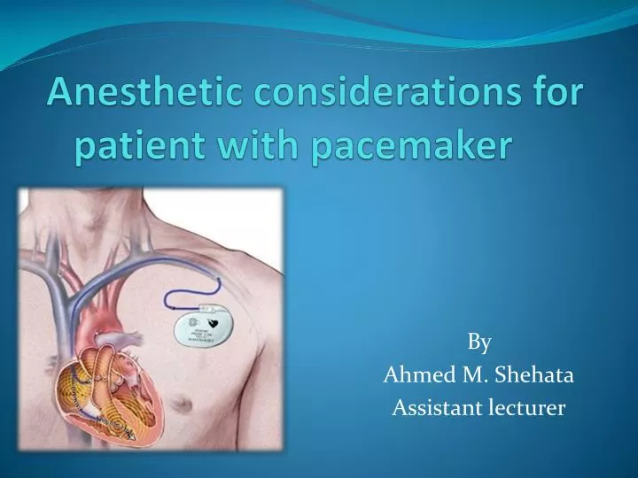 anesthetic considerations for patient with pacemaker