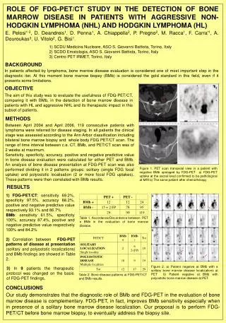 ROLE OF FDG-PET/CT STUDY IN THE DETECTION OF BONE MARROW DISEASE IN PATIENTS WITH AGGRESSIVE NON-HODGKIN LYMPHOMA (NHL)