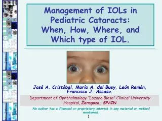 Management of IOLs in Pediatric Cataracts: When, How, Where, and Which type of IOL.
