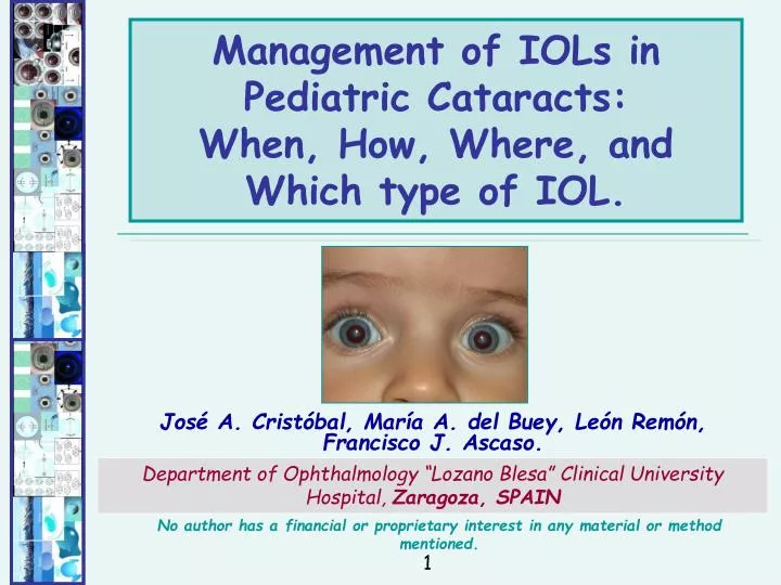 management of iols in pediatric cataracts when how where and which type of iol