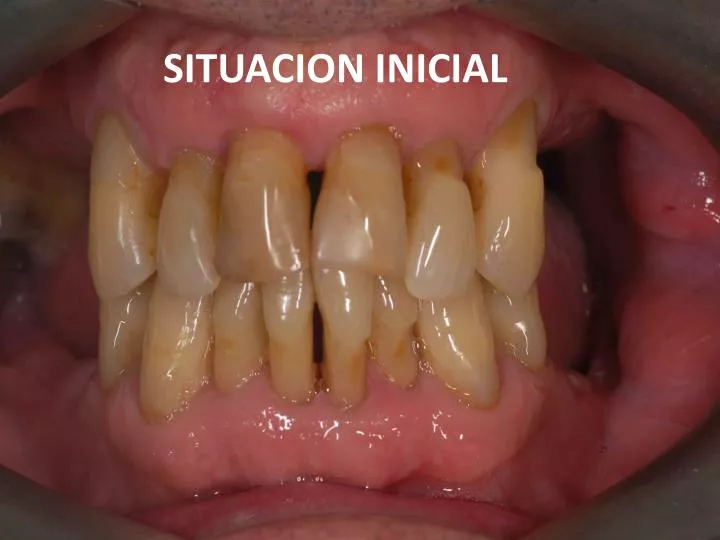 situacion inicial