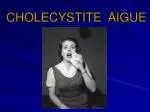 CHOLECYSTITE AIGUE - slide 1