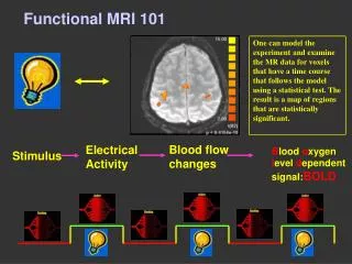 Functional MRI 101