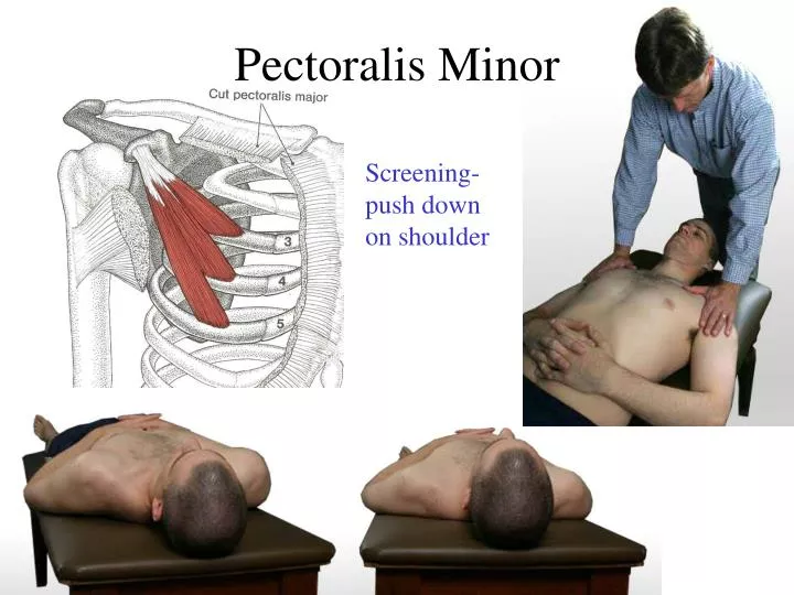 pectoralis minor