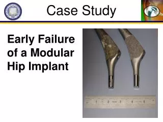 Early Failure of a Modular Hip Implant