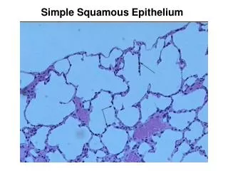 Simple Squamous Epithelium