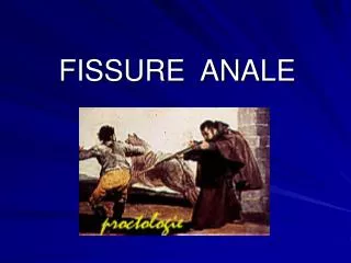 fissure anale