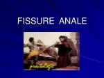 FISSURE ANALE - slide 1
